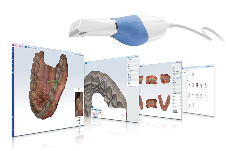 Il modulo Planmeca Romexis® CAD/CAM porta le impronte digitali a un livello superiore